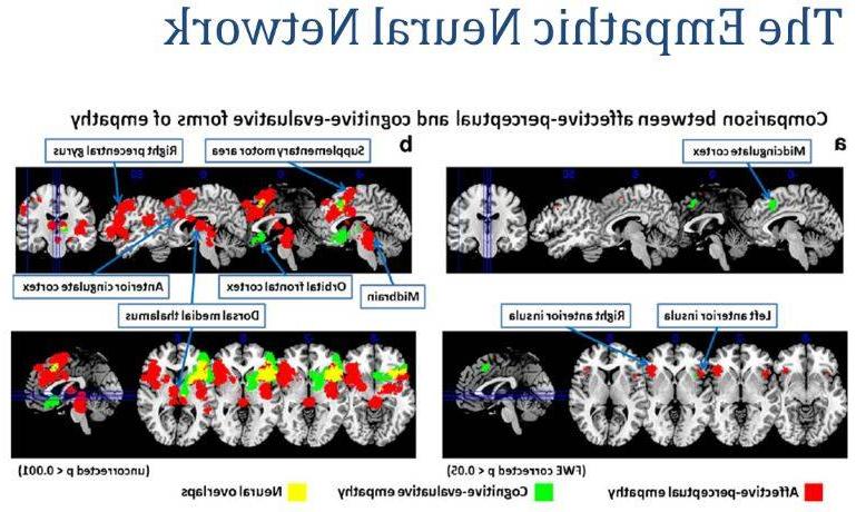 The Emphatic Neural Network